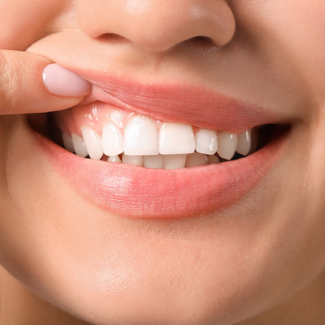 Image link